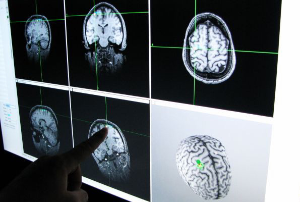 brain scans